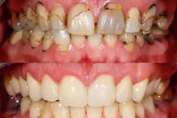 Rehabilitación Oral y Estética Dental